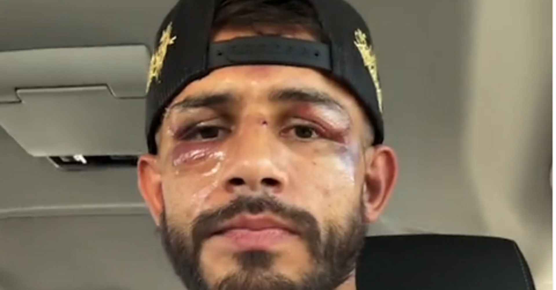 Яир Родригес публикува съобщение след загубата на UFC 290