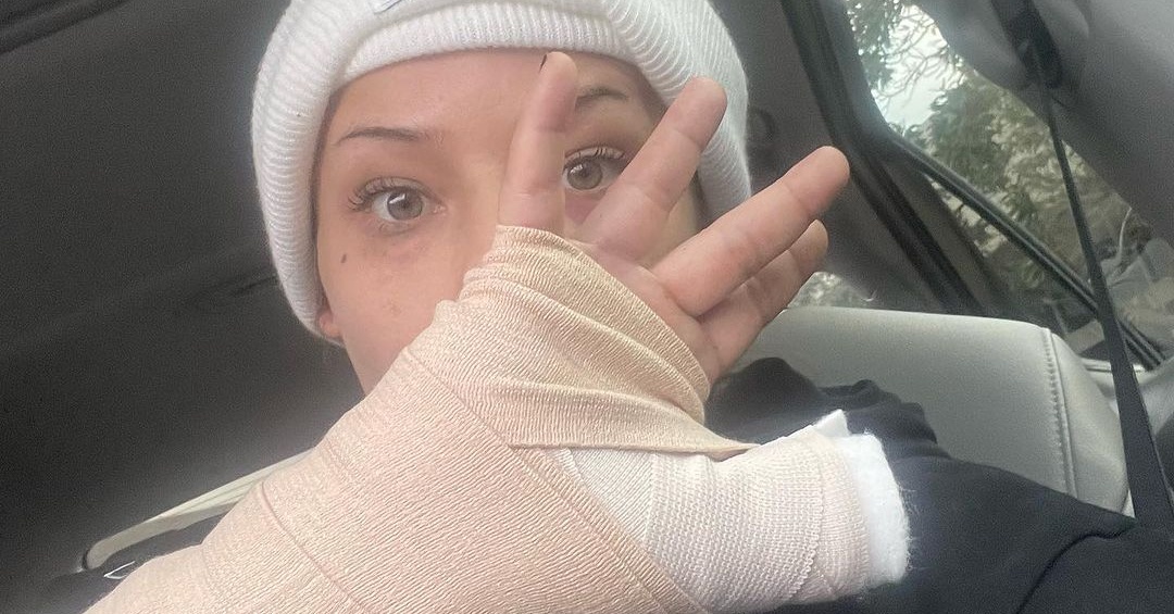 Джени Савидж показа счупената си ръка след боя с Тайлър Старлинг