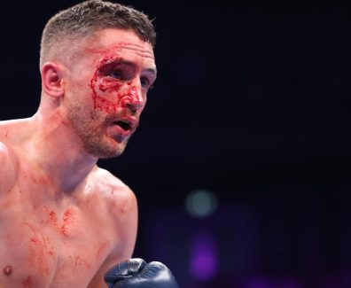 Снимка: Matchroom Boxing
