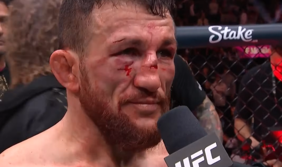 Грозна гледка: Вижте как изглежда Мераб след боя от Ян (СНИМКА)